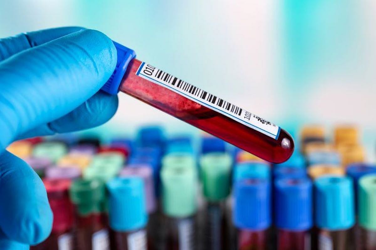Blood Test Might Predict Rapid Decline in Alzheimer's Patients